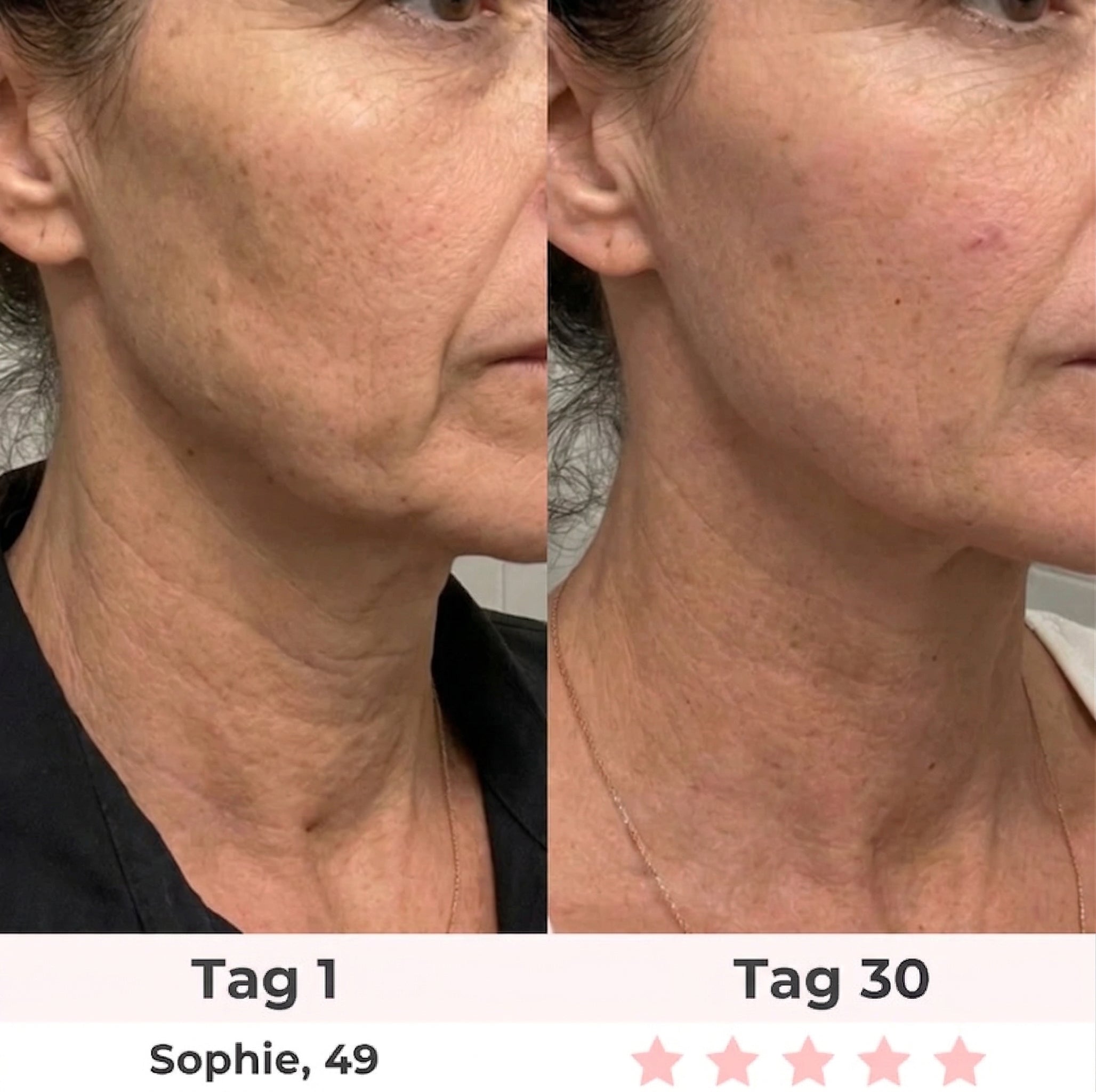 Rosevie 7-in-1 LED Gesichtssculptor